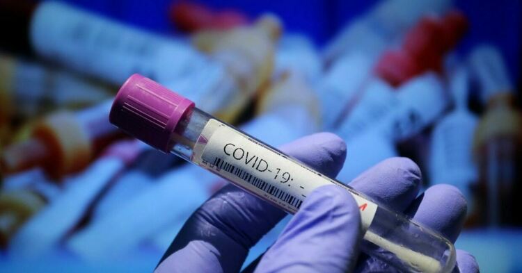 Значителен ръст на новите случаи на COVID-19 